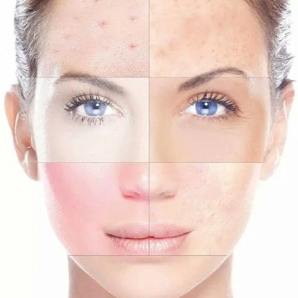 A woman's face with different skin types.