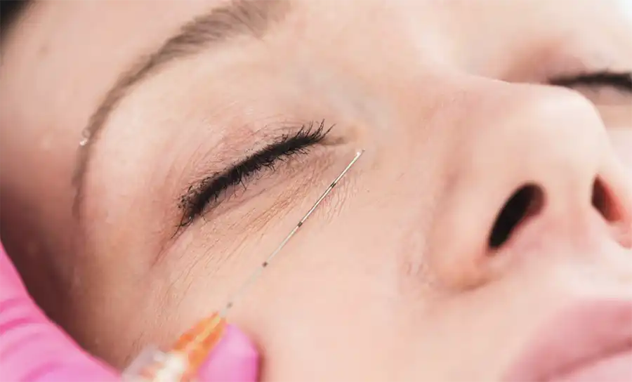 tear trough treatment