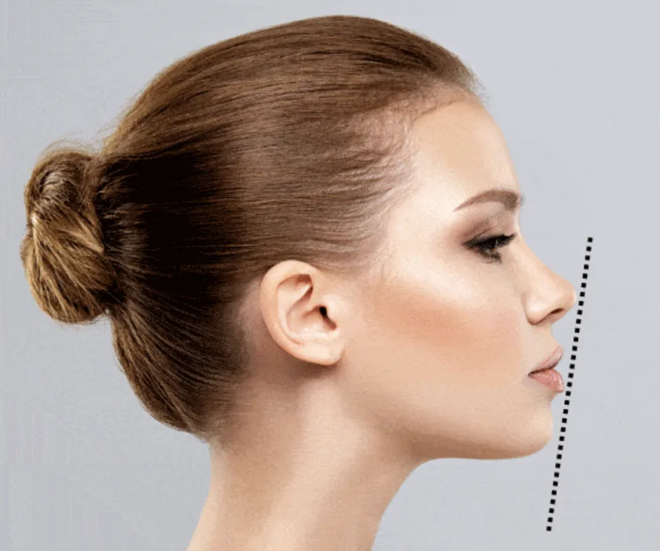 A woman's face with a dotted line in the middle of her nose.