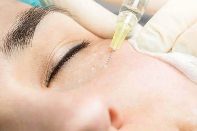 treatments sunekos under eye treatment